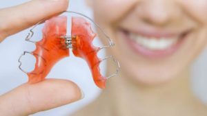Festsitzende Zahnspange Infos Kosten Und Behandlungsablauf