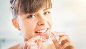 Zahnspange Invisalign - Die perfekte Zahnspange?