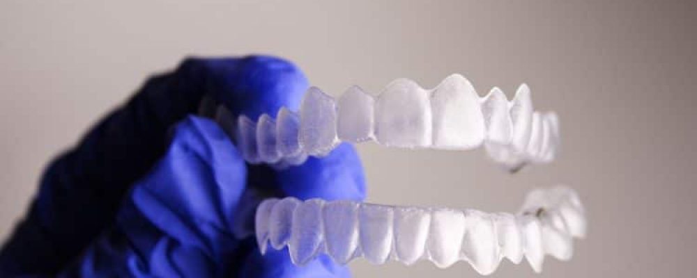 Vorteile und Nachteile der Invisalign© Zahnspange in Österreich 2